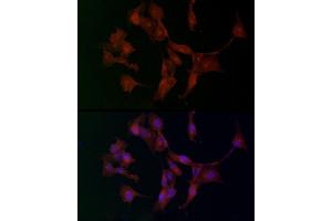 Immunofluorescence analysis of U-87 MG cells using  Rabbit pAb (ABIN3016805, ABIN3016806, ABIN3016807 and ABIN6219845) at dilution of 1:100. (ADAMTS5 Antikörper  (AA 731-930))