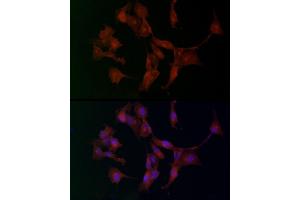 Immunofluorescence (IF) image for anti-ADAM Metallopeptidase with thrombospondin Type 1 Motif, 5 (ADAMTS5) (AA 731-930) antibody (ABIN3016806)