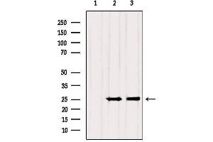 Western blot analysis of extracts from various samples, using RAB3A Antibody. (RAB3A Antikörper  (N-Term))