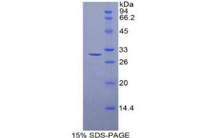 SDS-PAGE analysis of Rat Histone Deacetylase 6 Protein. (HDAC6 Protein)