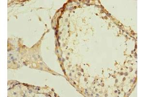 Immunohistochemistry of paraffin-embedded human testis tissue using ABIN7175982 at dilution of 1:100 (ZBTB43 Antikörper  (AA 165-467))