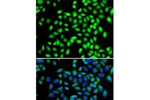 Immunofluorescence analysis of A-549 cells using SGTA Polyclonal Antibody (SGTA Antikörper)