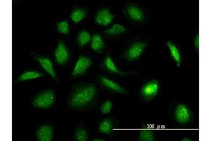 Immunofluorescence of monoclonal antibody to GART on HeLa cell. (GART Antikörper  (AA 1-433))