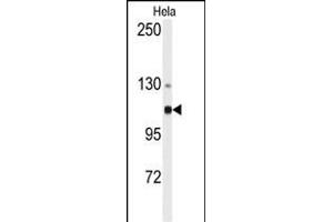 Western blot analysis of anti-ACTN4 Antibody (N-term) (ABIN392218 and ABIN2841914) in Hela cell line lysates (35 μg/lane). (alpha Actinin 4 Antikörper  (N-Term))