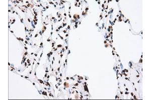 Image no. 3 for anti-Transforming, Acidic Coiled-Coil Containing Protein 3 (TACC3) antibody (ABIN1498096) (TACC3 Antikörper)