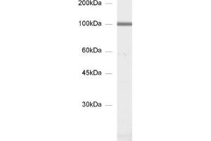 dilution: 1 : 1000, sample: synaptic membrane fraction of rat brain (LP1) (GluA 3 (AA 860-871) Antikörper)