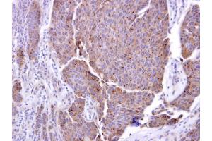 Immunohistochemistry (IHC) image for anti-ADAM Metallopeptidase Domain 17 (ADAM17) (C-Term) antibody (ABIN2855021)