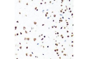 Immunohistochemistry of paraffin-embedded mouse brain using H1F0 antibody at dilution of 1:100 (x40 lens). (Histone H1 Antikörper)