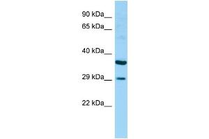 Retinoic Acid Early Transcript 1G (RAET1G) (Middle Region) Antikörper