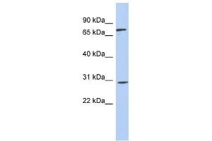 Western Blot showing ZNF131 antibody used at a concentration of 1-2 ug/ml to detect its target protein. (ZNF131 Antikörper  (Middle Region))