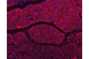 IF analysis of SLU7 using anti-SLU7 antibody (ABIN7601697). (SLU7 Antikörper  (AA 42-474))