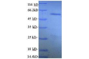 SDS-PAGE (SDS) image for Fused in Sarcoma (FUS) (AA 1-198), (partial) protein (GST tag) (ABIN1608021)