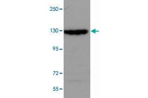 SRGAP2 polyclonal antibody  (0. (SRGAP2 Antikörper  (Internal Region))
