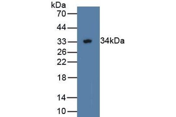 WWP2 抗体  (AA 601-870)