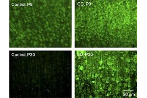 Expression of TRPC3 in rat cortex.