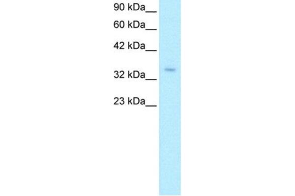 ZNF391 Antikörper  (N-Term)