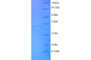 SDS-PAGE (SDS) image for Chemokine (C-C Motif) Ligand 22 (CCL22) (AA 25-82), (partial) protein (GST tag) (ABIN5712431)