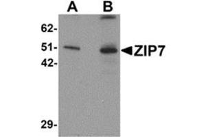 Western blot analysis of ZIP7 in mouse brain tissue lysate with ZIP7 antibody at (A) 0.