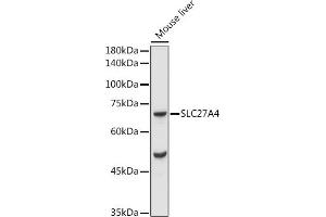 Western blot analysis of extracts of Mouse liver, using F/SLC27 antibody (ABIN7270444) at 1:1000 dilution.