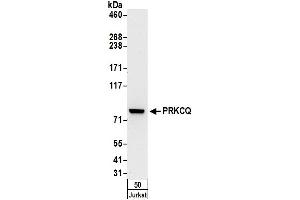 Western Blotting (WB) image for anti-Protein Kinase C, theta (PRKCQ) (AA 656-706) antibody (ABIN7450605)