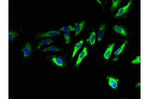 Immunofluorescence (IF) image for anti-Transmembrane Protein 65 (TMEM65) (AA 63-240) antibody (ABIN7173261)