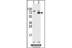 Western blot analysis of SWAP70 using rabbit polyclonal SWAP70 Antibody using 293 cell lysates (2 ug/lane) either nontransfected (Lane 1) or transiently transfected with the SWAP70 gene (Lane 2).