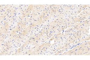 Immunohistochemistry (IHC) image for anti-Cholinergic Receptor, Nicotinic, beta 2 (Neuronal) (CHRNB2) (AA 86-244) antibody (ABIN7433732)