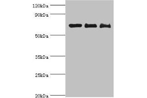 Western blot All lanes: CD6 antibody at 4 μg/mL Lane 1: Hela whole cell lysate Lane 2: Jurkat whole cell lysate Lane 3: HT-29 whole cell lysate Secondary Goat polyclonal to rabbit IgG at 1/10000 dilution Predicted band size: 72, 69, 64, 65, 59, 61 kDa Observed band size: 72 kDa