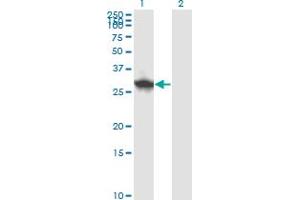 Western Blotting (WB) image for anti-Defective in Cullin Neddylation 1, Domain Containing 1 (DCUN1D1) (AA 1-89) antibody (ABIN565719)