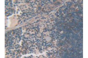 IHC-P analysis of Mouse Spleen Tissue, with DAB staining. (Gelsolin Antikörper  (AA 432-625))