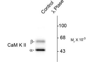 Image no. 1 for anti-Calcium/calmodulin-Dependent Protein Kinase II alpha (CAMK2A) (pThr286) antibody (ABIN372889) (CAMK2A Antikörper  (pThr286))