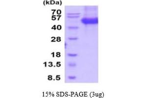 SDS-PAGE (SDS) image for Secreted Frizzled-Related Protein 4 (SFRP4) (AA 19-346) protein (His tag) (ABIN6387920) (SFRP4 Protein (AA 19-346) (His tag))