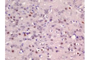 Formalin-fixed and paraffin embedded rat brain labeled with Rabbit Anti-ER81 Polyclonal Antibody, Unconjugated (ABIN1385970) at 1:200 followed by conjugation to the secondary antibody and DAB staining (ETV1 Antikörper  (AA 21-120))