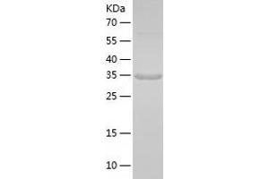 Western Blotting (WB) image for Melanoma Antigen Family A, 6 (MAGEA6) (AA 1-314) protein (His tag) (ABIN7123891) (MAGEA6 Protein (AA 1-314) (His tag))