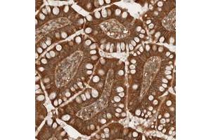 Immunohistochemical staining of human small intestine with ARFGEF2 polyclonal antibody  shows distinct cytoplasmic positivity in glandular cells.