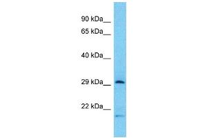 Western Blotting (WB) image for anti-Tryptase beta 2 (TPSB2) (Middle Region) antibody (ABIN2500609) (TPSB2 Antikörper  (Middle Region))