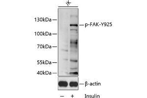 Western blot analysis of extracts of Jurkat cell line, using Phospho-FAK-Y925 antibody (ABIN6135297, ABIN6136216, ABIN6136217 and ABIN6225615) 1:1000 dilution. (FAK Antikörper  (pTyr925))