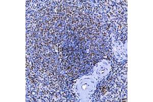 IHC analysis of SF3A1 using anti-SF3A1 antibody (ABIN7600556). (SF3A1 Antikörper  (AA 20-556))