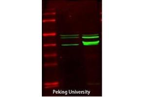 Western Blot (WB) analysis: Please contact us for more details. (CKM Antikörper  (N-Term))