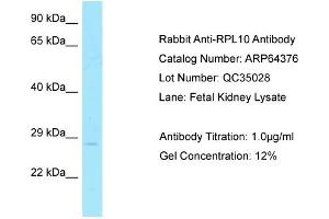 Western Blotting (WB) image for anti-Ribosomal Protein L10 (RPL10) (C-Term) antibody (ABIN2789821)