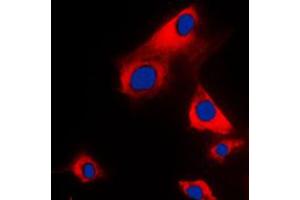 Immunofluorescent analysis of Glycerol Kinase 1 staining in H9C2 cells. (Glycerol Kinase 1 Antikörper  (C-Term))