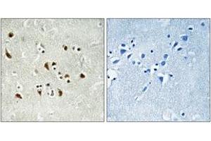 Immunohistochemistry (IHC) image for anti-Tubulin, gamma Complex Associated Protein 6 (TUBGCP6) (AA 741-790) antibody (ABIN2890337) (GCP6 Antikörper  (AA 741-790))