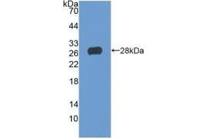 Detection of Recombinant TIGIT, Human using Polyclonal Antibody to T-Cell Immunoreceptor With Ig And ITIM Domains Protein (TIGIT) (TIGIT Antikörper  (AA 21-234))