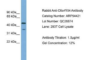 WB Suggested Anti-C6orf154  Antibody Titration: 0. (C6orf154 Antikörper  (N-Term))