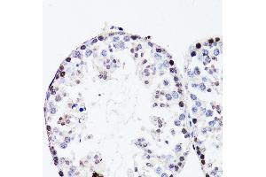 Immunohistochemistry of paraffin-embedded mouse testis using FGF12 antibody (ABIN3016419, ABIN3016420, ABIN1679841 and ABIN6219744) at dilution of 1:150 (40x lens). (FGF12 Antikörper  (AA 1-181))