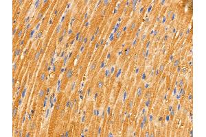 ABIN6263044 and ABIN6266704 at 1/100 staining Rat heart tissue by IHC-P.