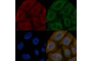 NAGK Mouse Monoclonal Antibody staining Hela cells by IF/ICC.