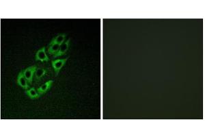 Immunofluorescence analysis of A549 cells, using MtSSB antibody. (SSBP1 Antikörper  (C-Term))