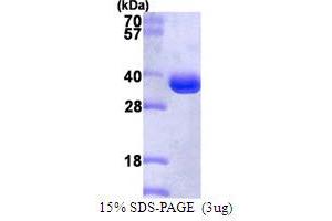 SDS-PAGE (SDS) image for Proteasome Subunit alpha Type 1 (PSMA1) (AA 1-263) protein (His tag) (ABIN667581)