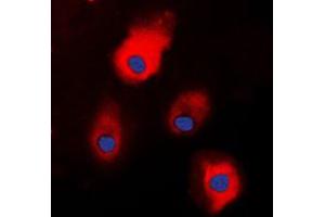 Immunofluorescent analysis of S100-A1 staining in HEK293T cells.